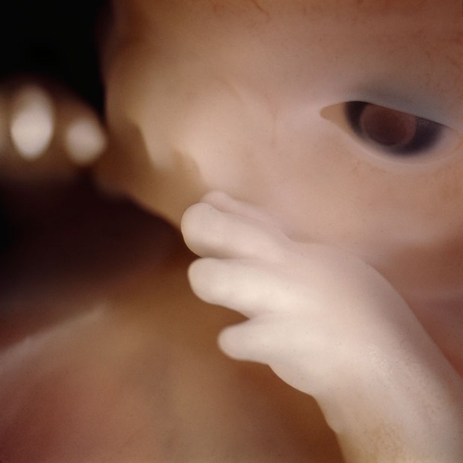 zanim zobaczyliśmy świat. Lennart Nilsson, praca 7.